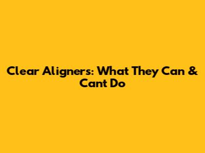 Clear Aligners: What They Can & Can't Do