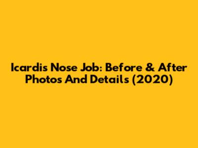 Icardi's Nose Job: Before & After Photos And Details (2020)