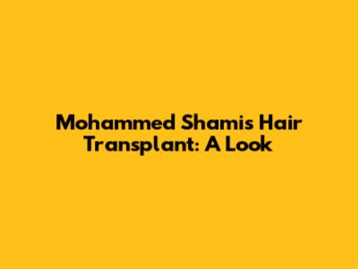 Mohammed Shami's Hair Transplant: A Look