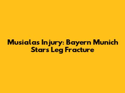 Musiala's Injury: Bayern Munich Star's Leg Fracture