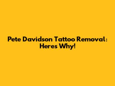Pete Davidson Tattoo Removal: Here's Why!