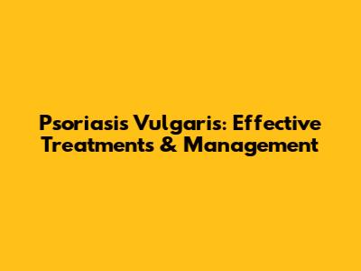Psoriasis Vulgaris: Effective Treatments & Management
