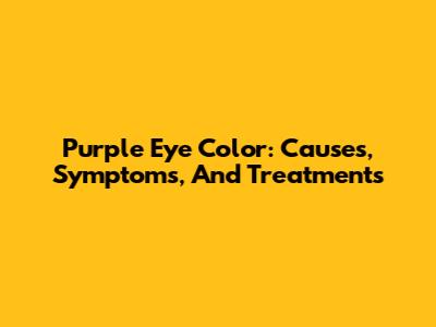 Purple Eye Color: Causes, Symptoms, And Treatments