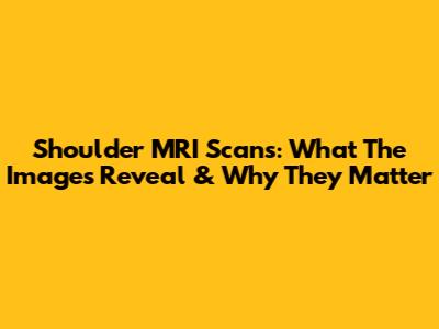 Shoulder MRI Scans: What The Images Reveal & Why They Matter