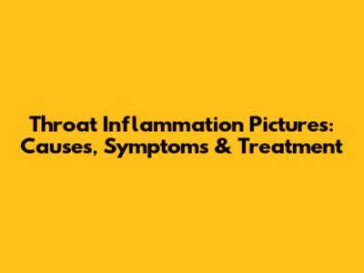 Throat Inflammation Pictures: Causes, Symptoms & Treatment